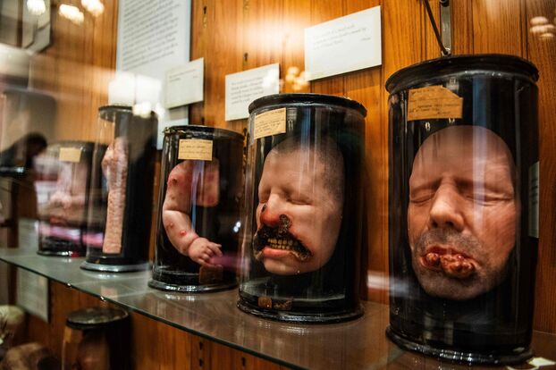 Vitrines anciennes du Musée Mütter de Philadelphie, remplies de spécimens médicaux et de crânes